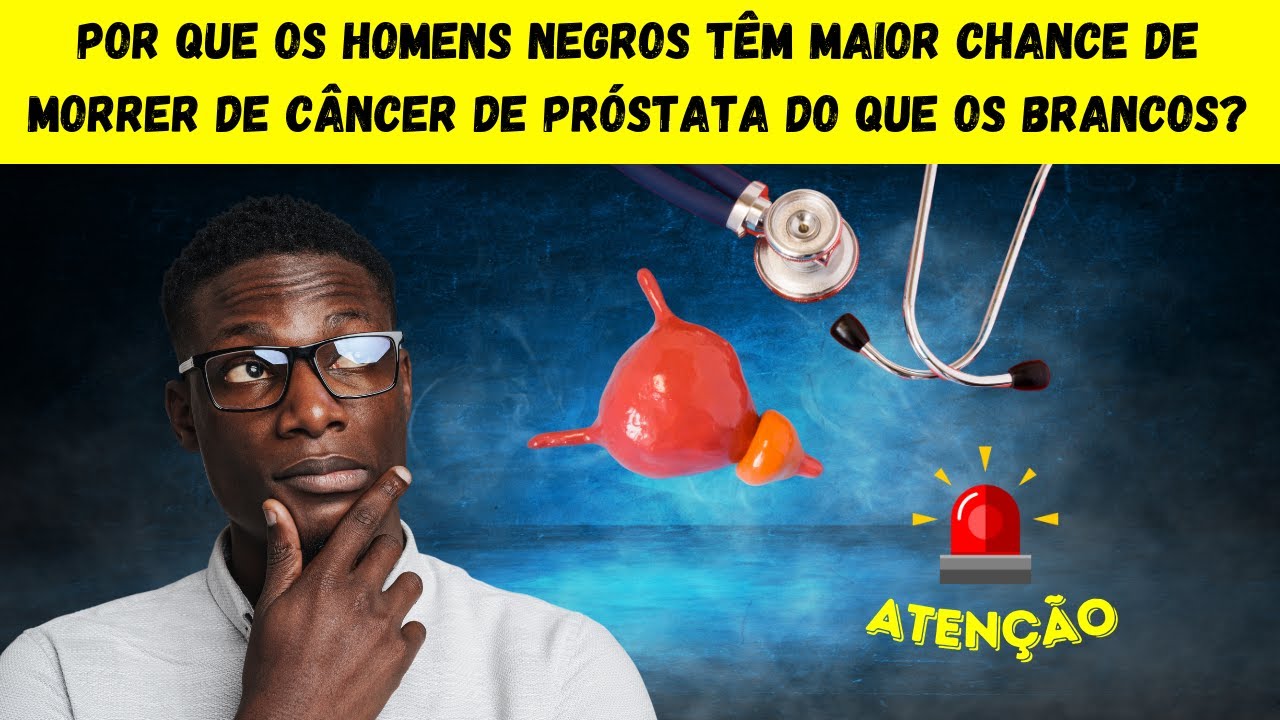 POR QUE OS HOMENS NEGROS T&Ecirc;M MAIOR CHANCE DE MORRER DE C&Acirc;NCER DE PR&Oacute;STATA DO QUE OS BRANCOS?