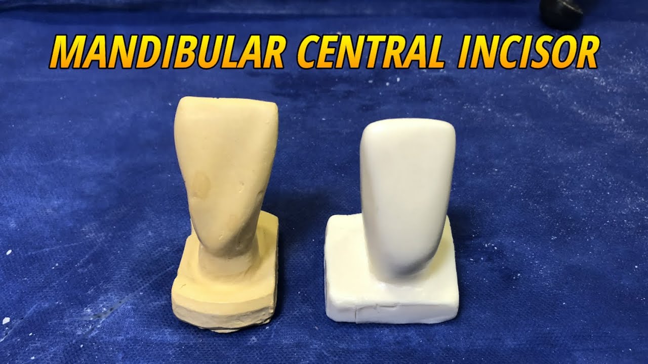 Carving of Mandibular Central Incisor (Tooth Morphology)