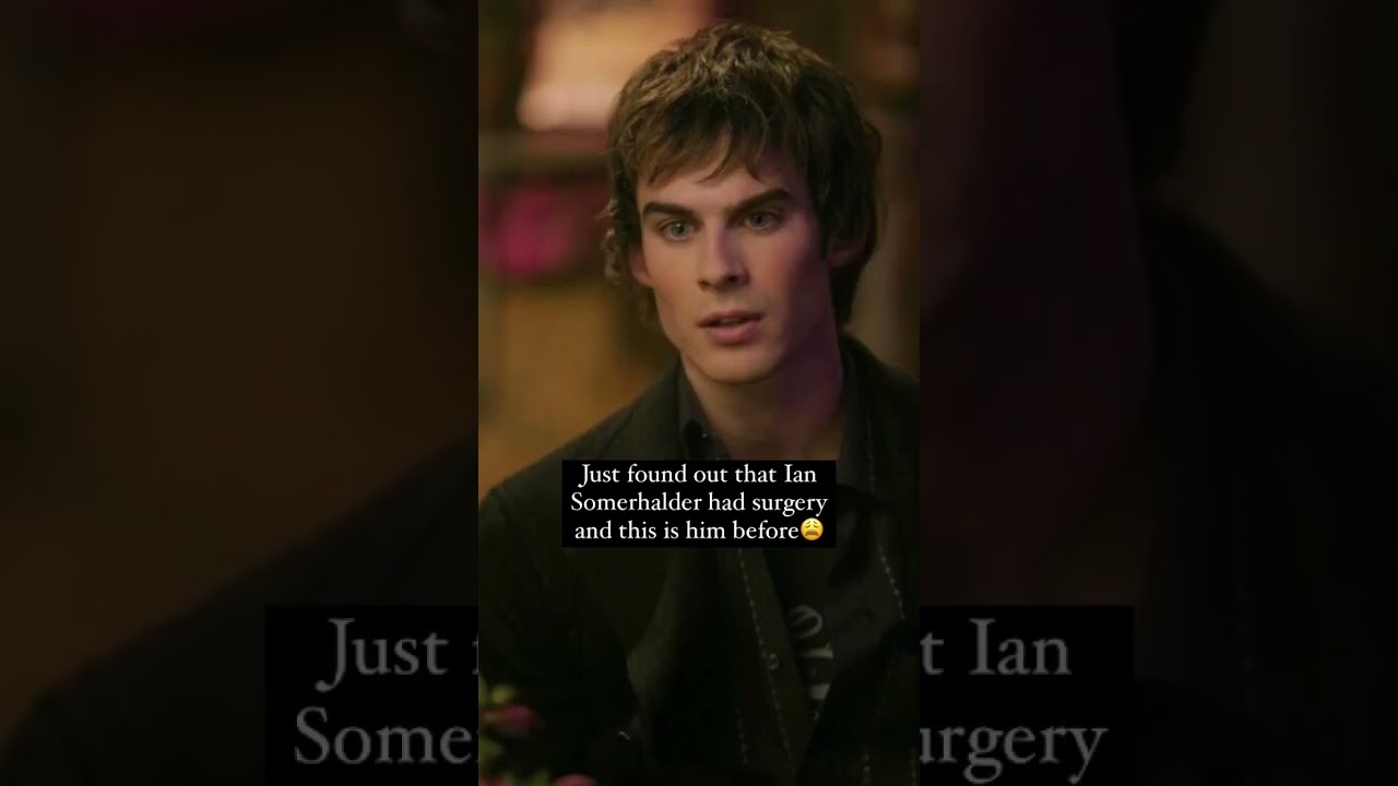 Ian Somerhalder before & after surgery #iansomerhalder #youtubeshorts #shorts