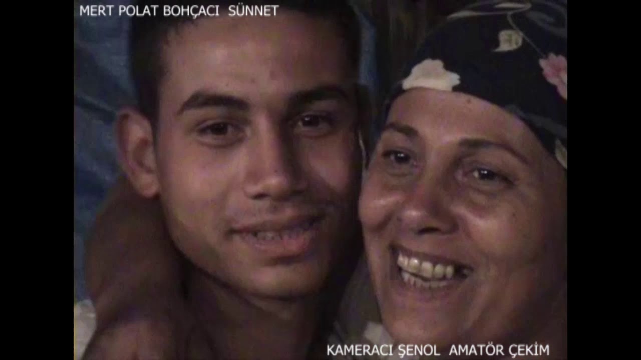 KAMERACI ŞENOL MERT POLAT BOHÇACI SÜNNET  DÜĞÜNÜ