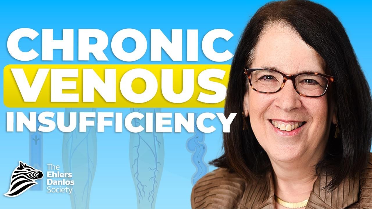 Venous Insufficiency in EDS and HSD | What You NEED TO KNOW