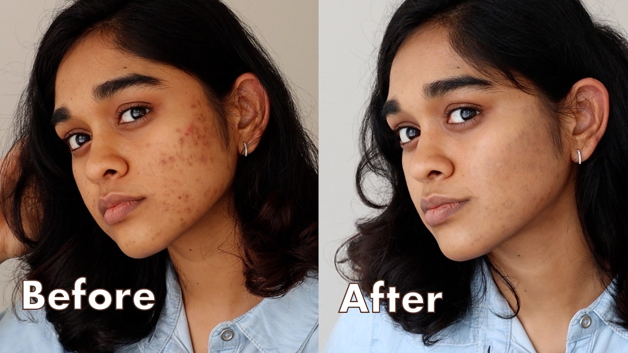 Minimal Makeup to Cover Acne Scars for Brown/Indian Skin  (very demure, very cutesy!)