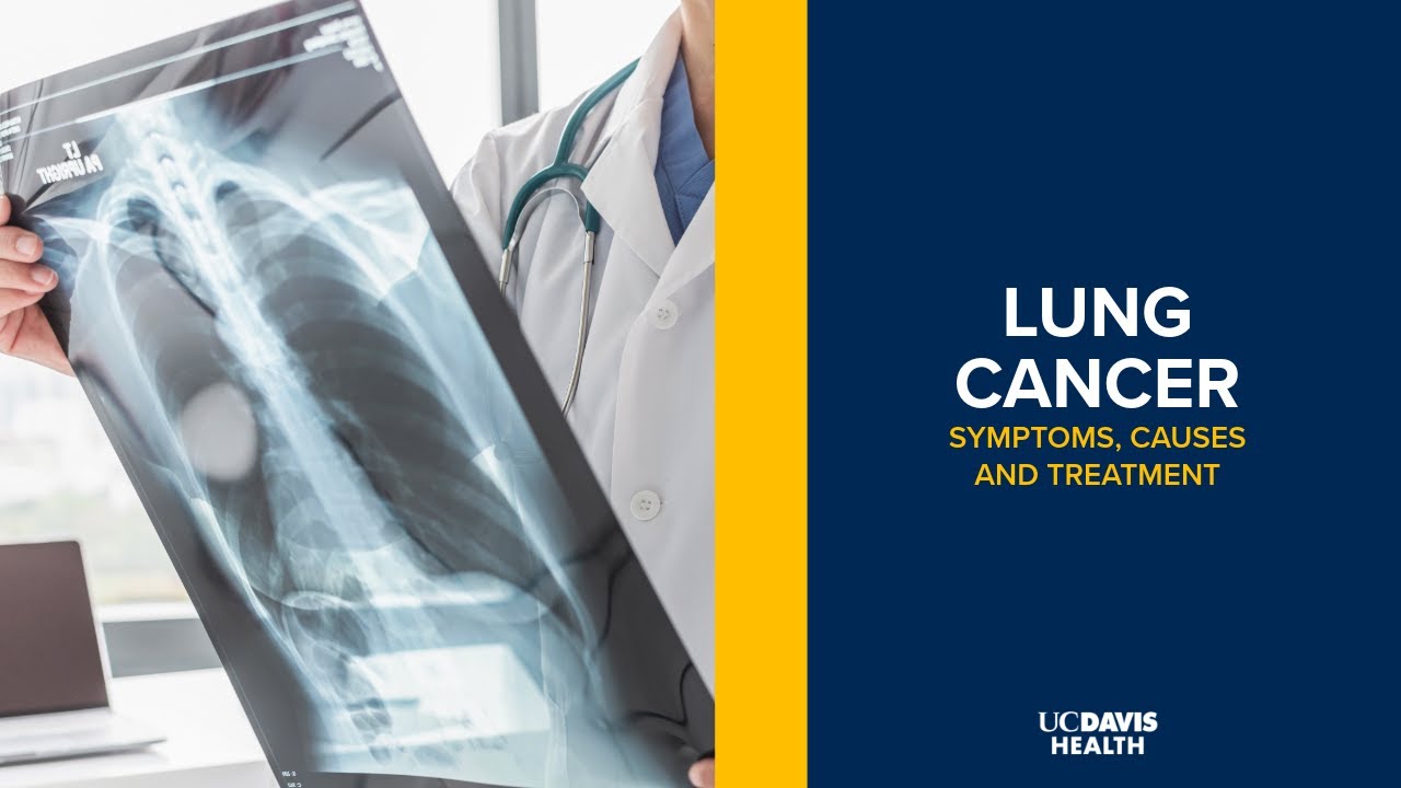 Lung Cancer - Symptoms, Causes and Treatment Options | UC Davis Health