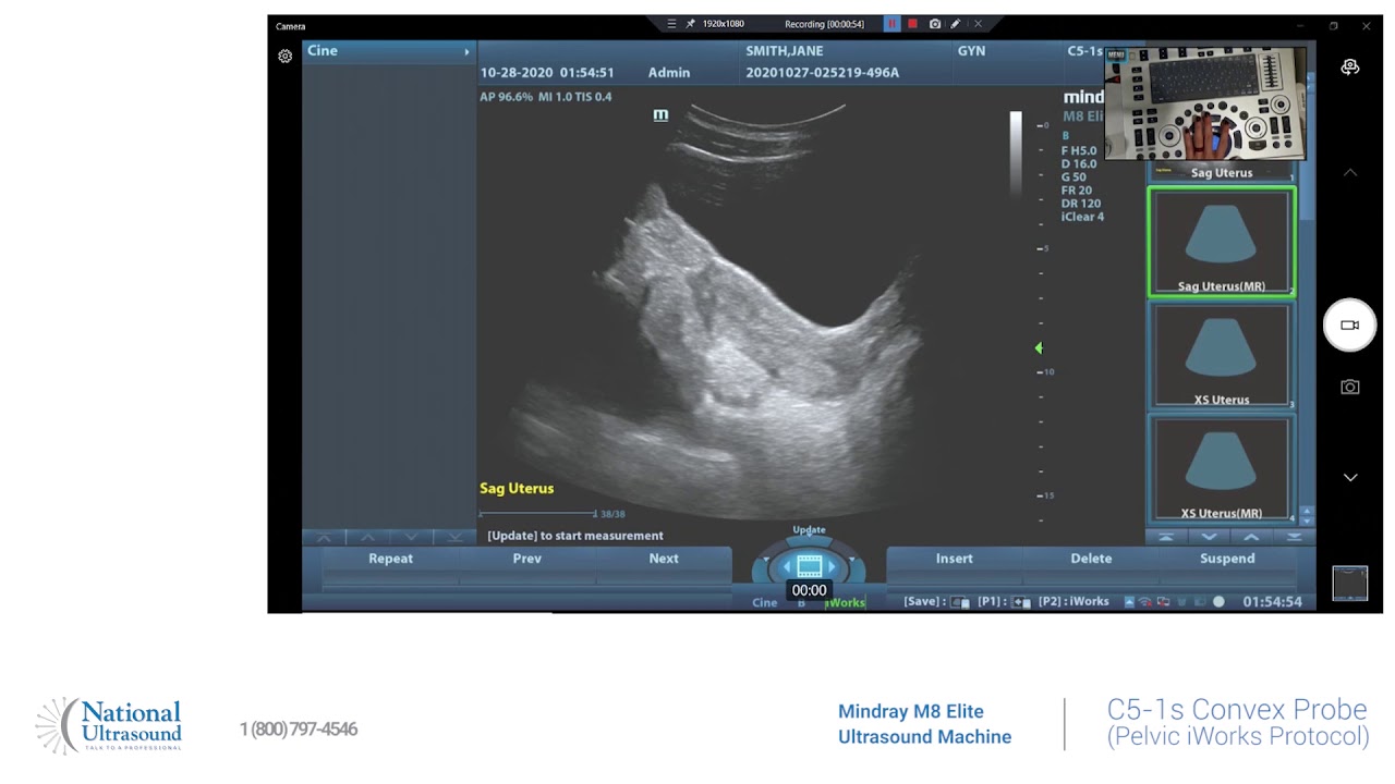 M8 Elite Pelvic iWorks Protocol Training Video