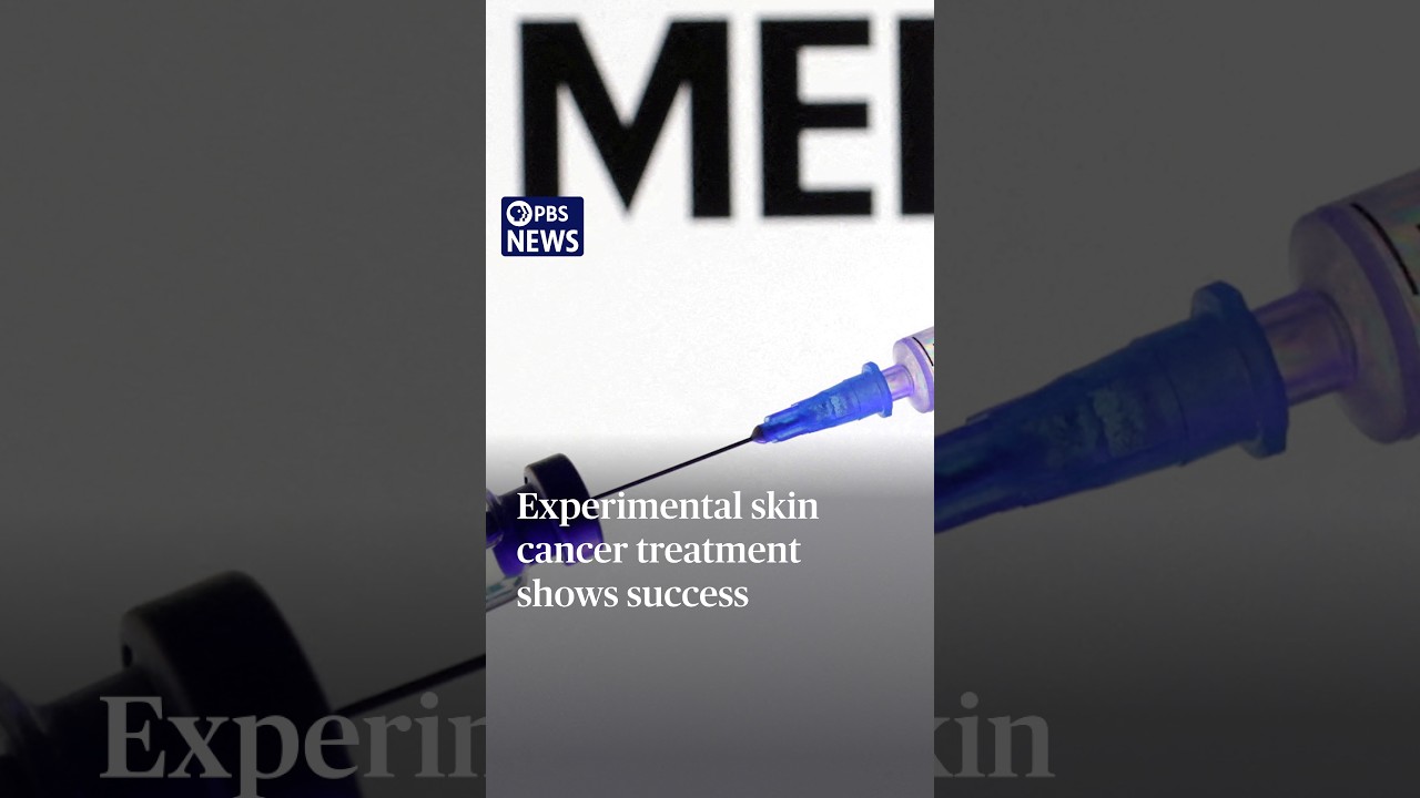 Experimental skin cancer treatment shows success