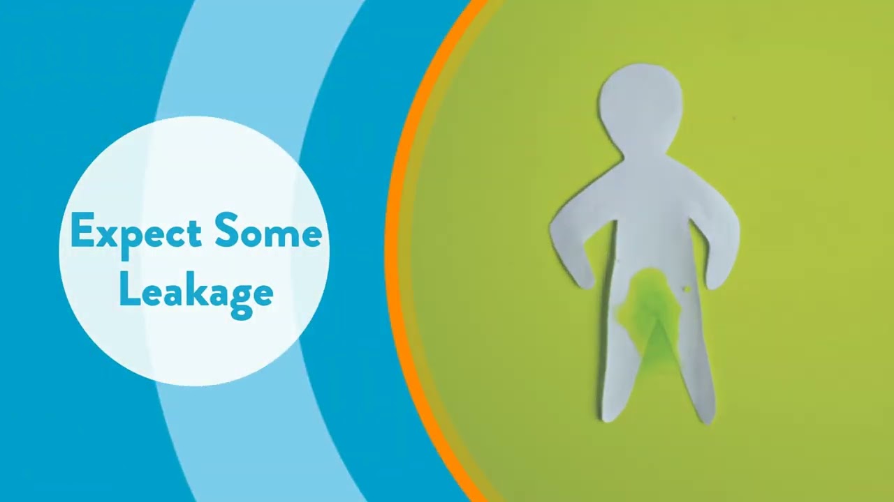 Managing Incontinence After Prostate Surgery