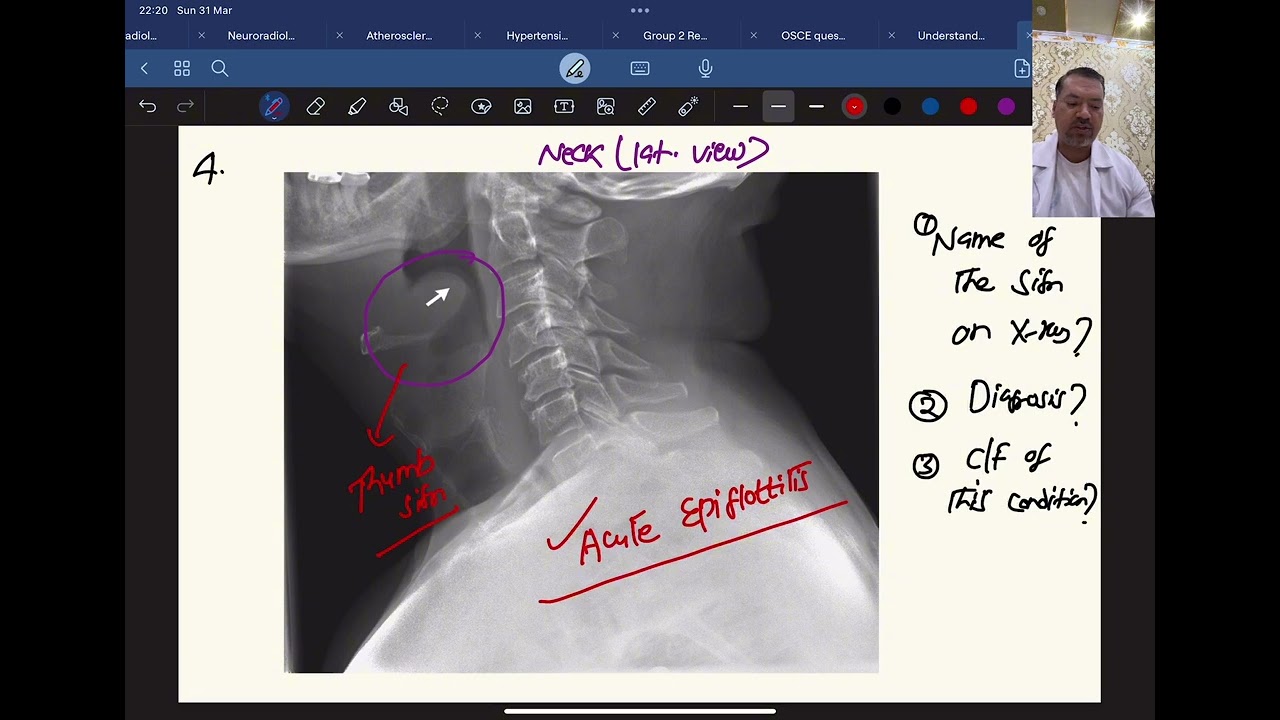 Pediatrics OSCE part I