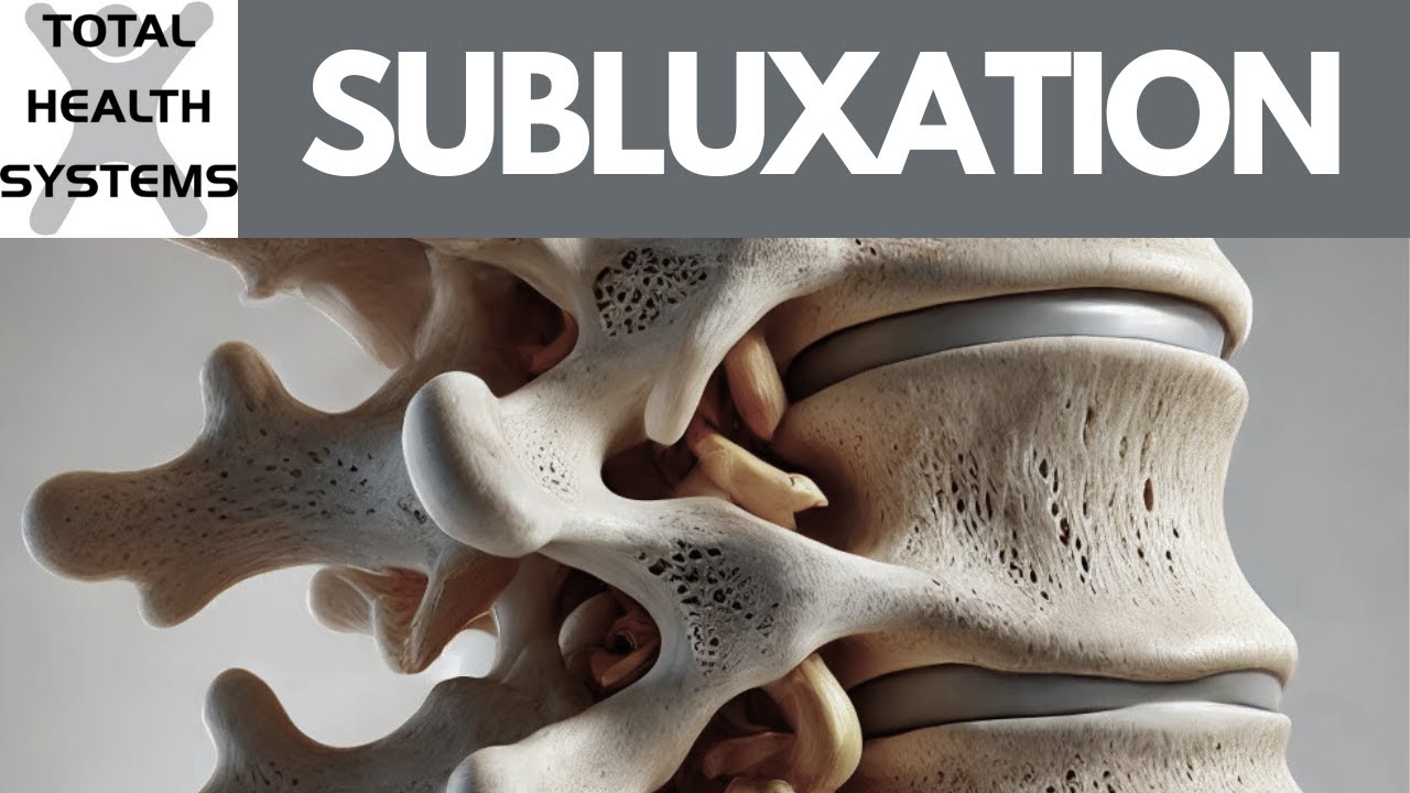 What Is A Subluxation?