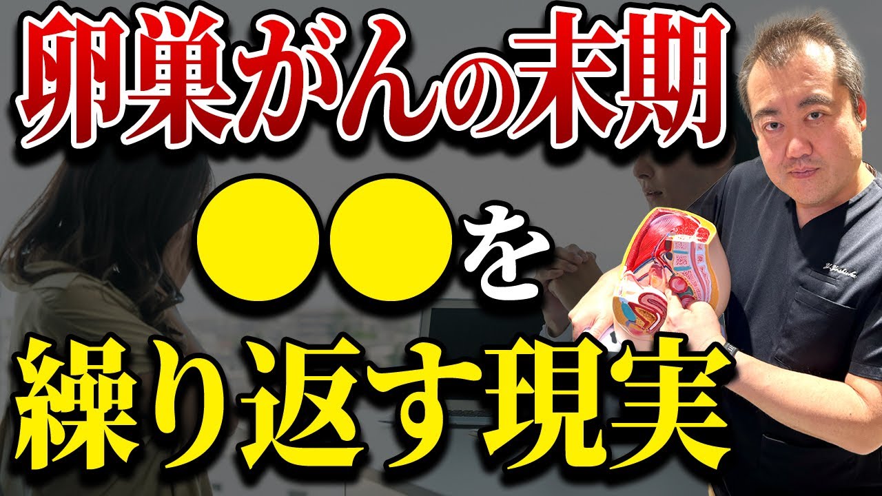 卵巣がんが進行するとどうなるのか!?産婦人科医が真実を話します