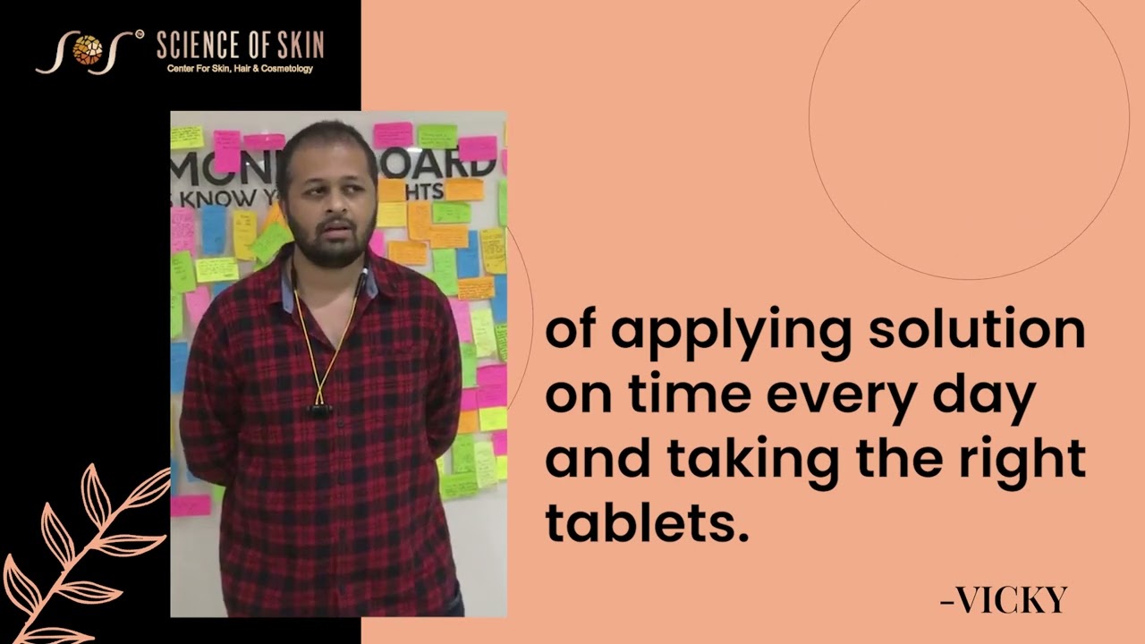 Hair Transplant Treatment | Client Review - Vicky | Science Of Skin Clinic