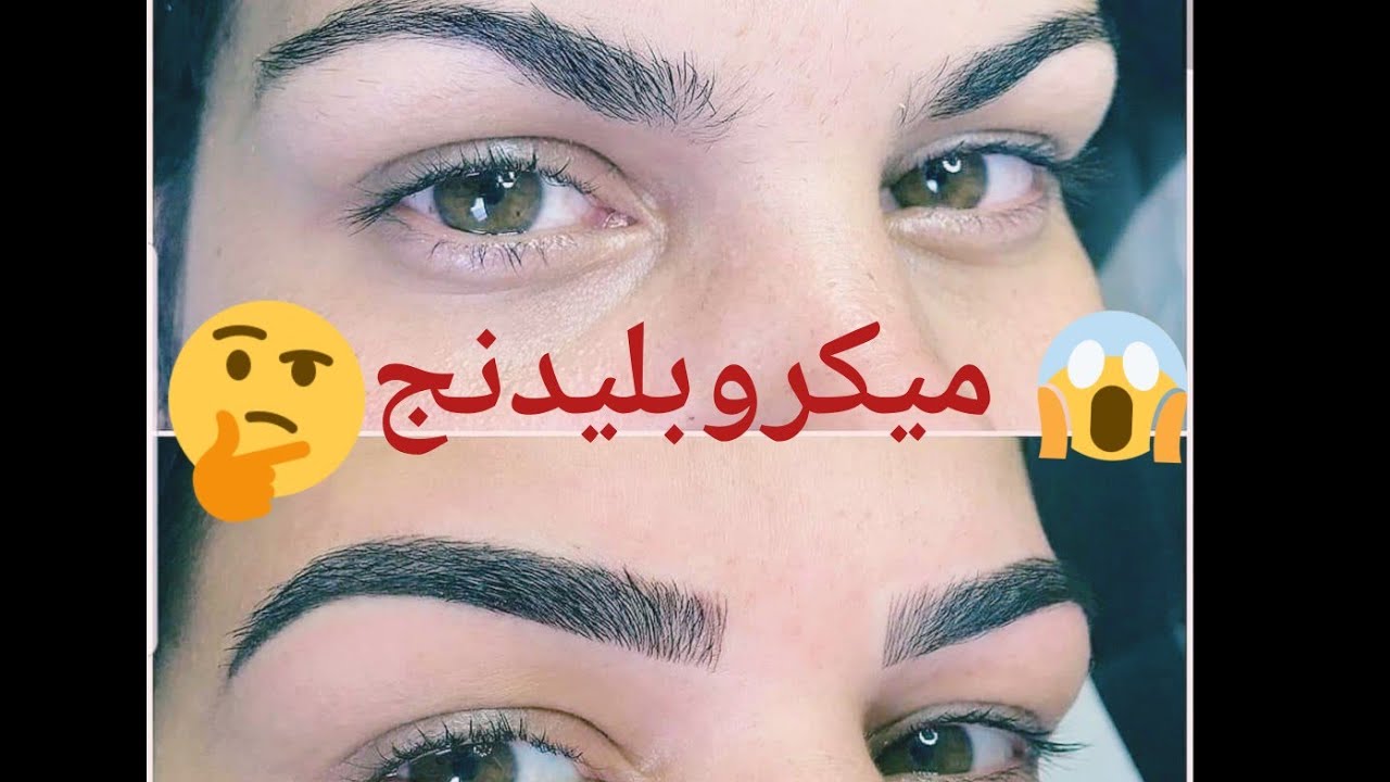 عملت ميكروبليدنج لنفسي خطوه بخطوه بالتفصيل والنتيجه غير متوقعه 😲😲