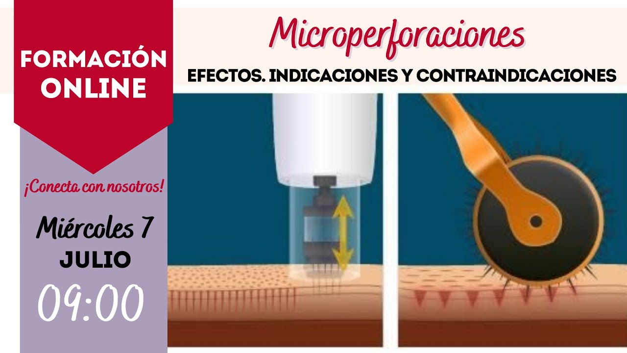Microperforaciones en la piel: efectos, contraindicaciones...