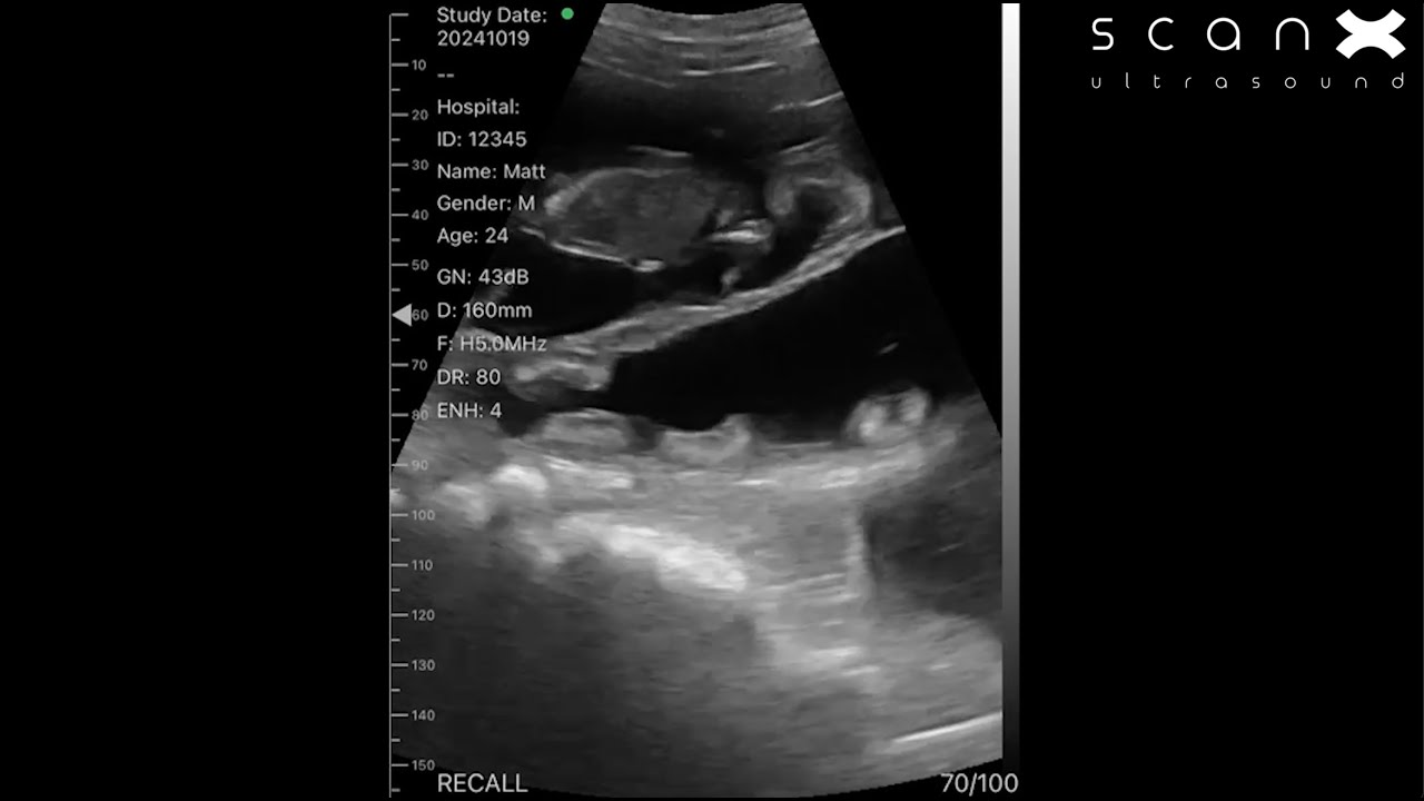 ScanX Air footage from pregnant dairy and Boer goats