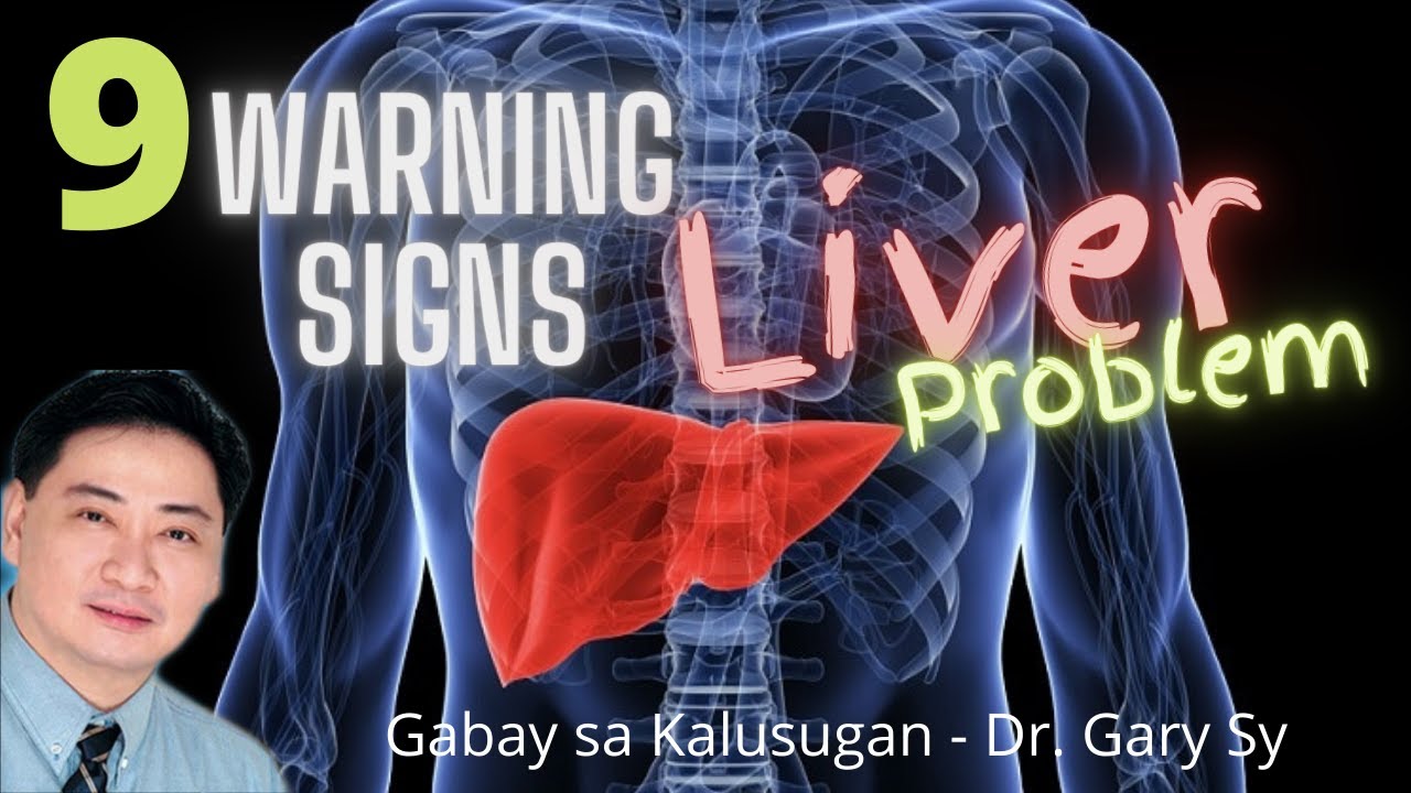9 Warning Signs of Liver Problem - Dr. Gary Sy