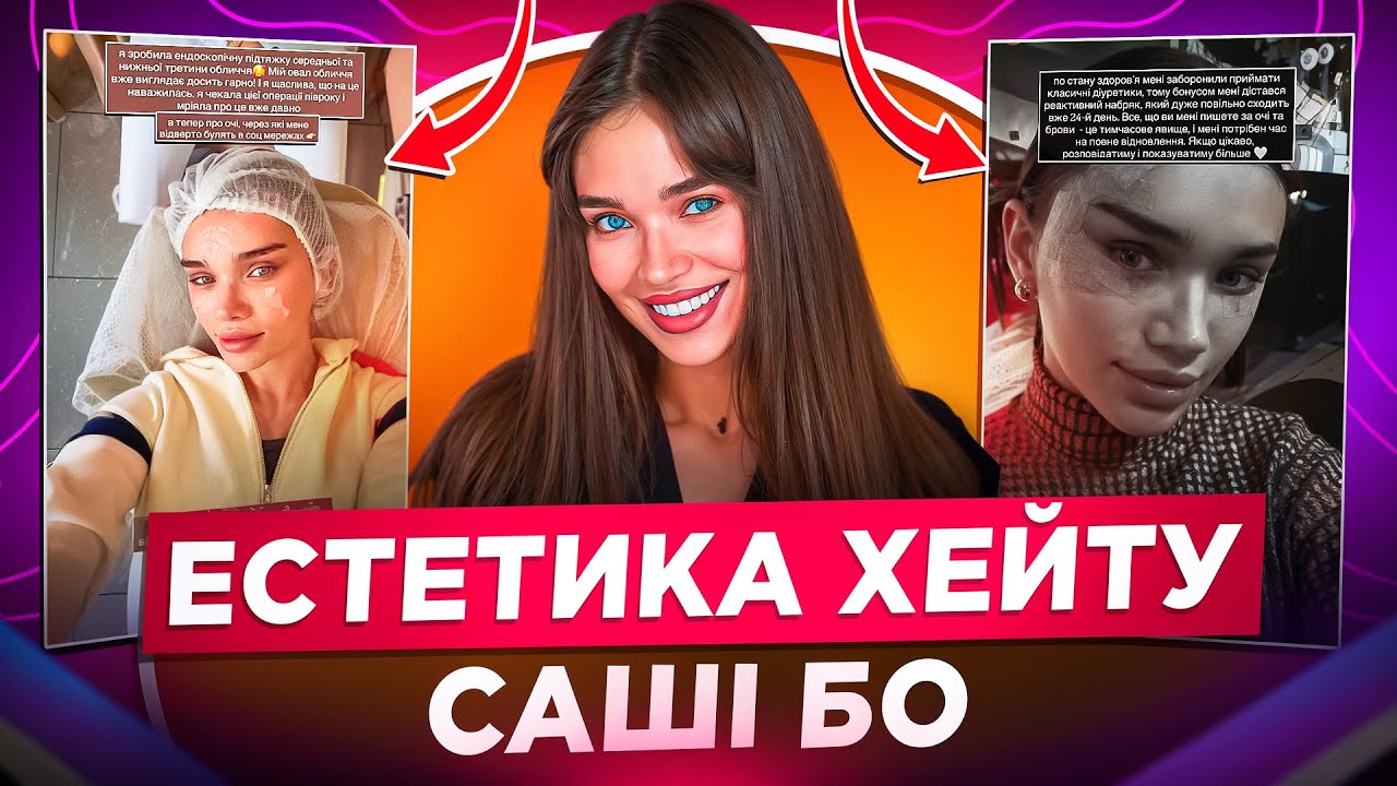 ПРОЦЕДУРИ САШІ БО: СВОБОДА ЧИ НЕВПЕВНЕНІСТЬ? ЧОМУ ЇЇ ЗВИНУВАЧУЮТЬ У НЕЩИРОСТІ ТА ДИСМОРФОФОБІЇ?