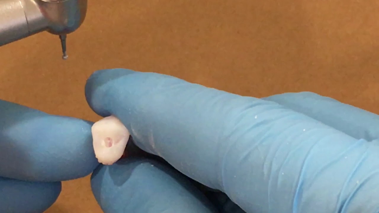 CIRURGIA DE ACESSO- PRÉ-MOLAR SUPERIOR
