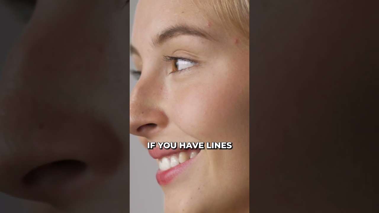 3 SIGNS YOU HAD TOO MUCH BOTOX