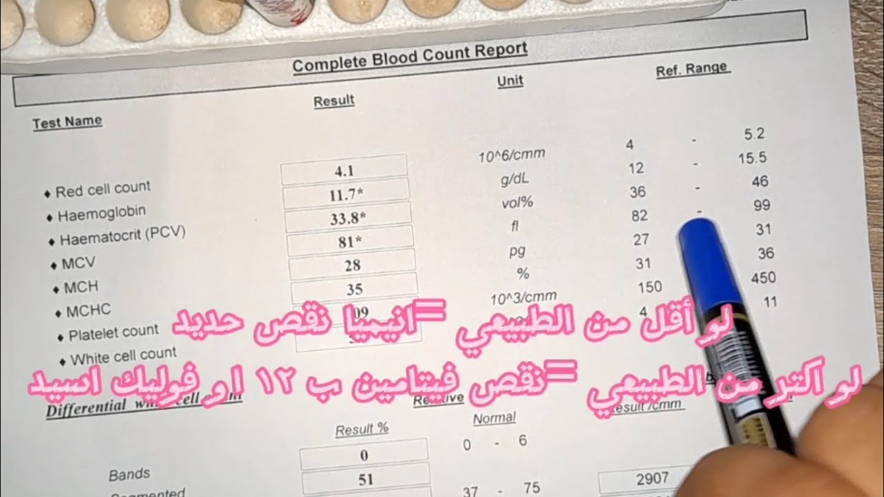قراءة تحليل صورة الدم الكاملة(CBC)