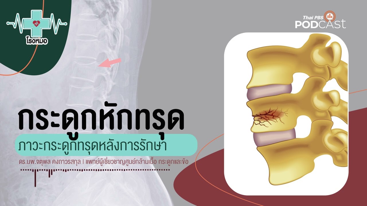 ภาวะกระดูกหักและทรุด | โรงหมอ
