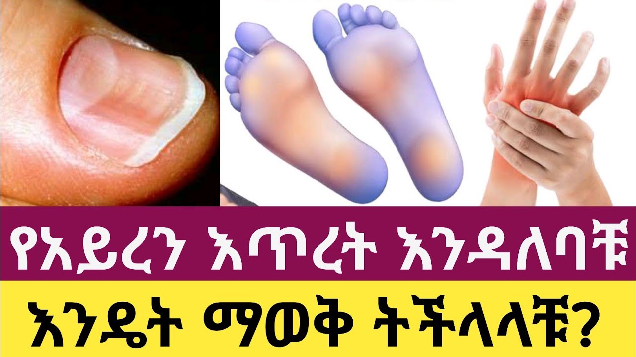 ሰውነታችሁ ተጨማሪ ብረት/አይረን እንደሚፈልግ የሚጠቁሙ 7 ምልክቶች| የአይረን እጥረት | 7 Signs Your Body Needs More Iron
