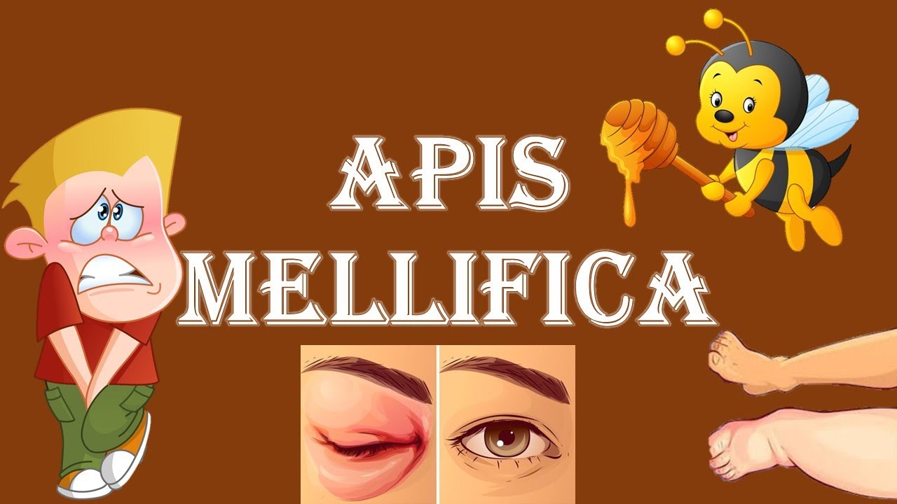 ||APIS MELLIFICA-HOMOEOPATHIC MEDICINE||ALLEN KEYNOTES EXPLAINED ||DR.DEEKSHA||