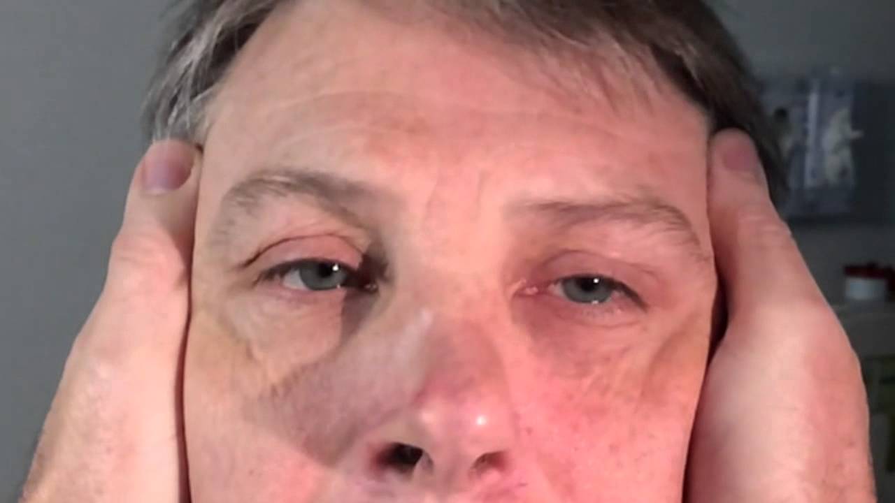 120 fps Positive Head Impulse Test