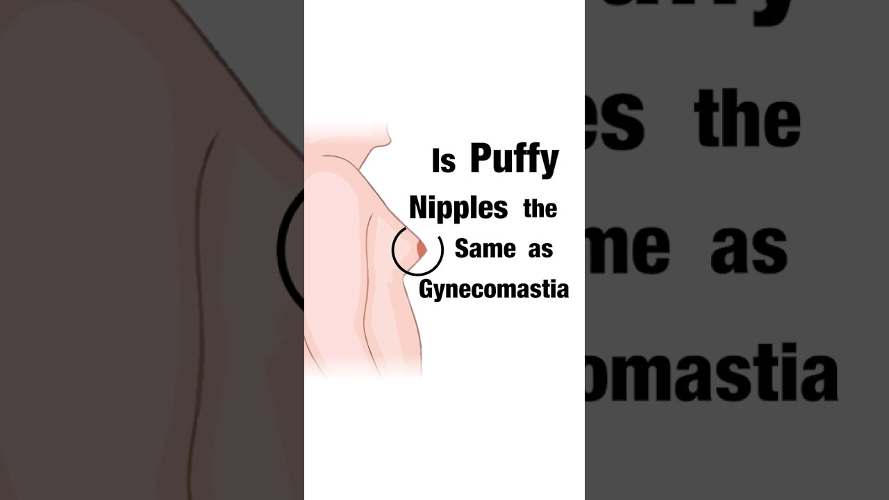 Are Puffy Nipples The Same As Gynecomastia? Dr. Aniketh Venkataram, The Venkat Center,&nbsp;Bengaluru