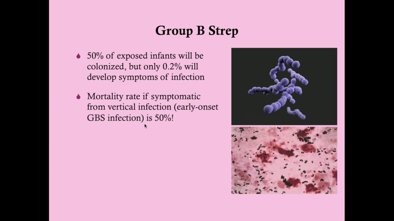 Group B Strep in Pregnancy - CRASH! Medical Review Series