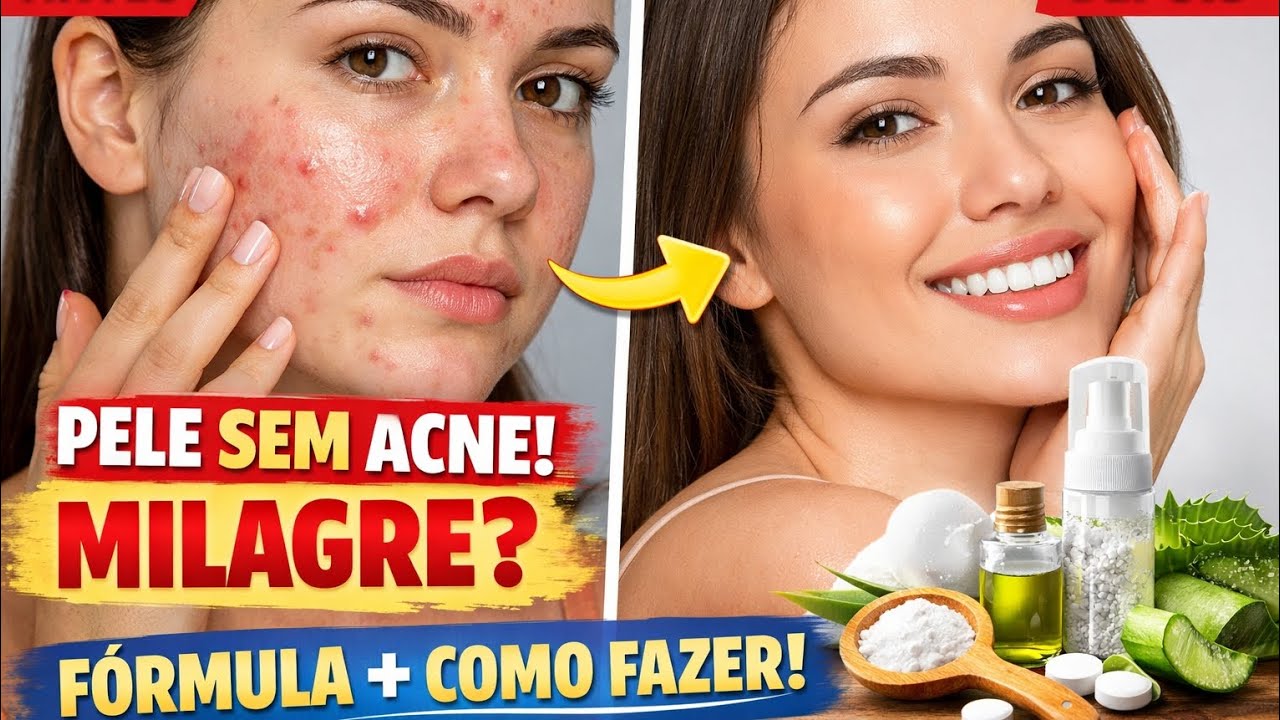 COMO FAZER SABONETE LÍQUIDO PARA PELE ACNEICA?