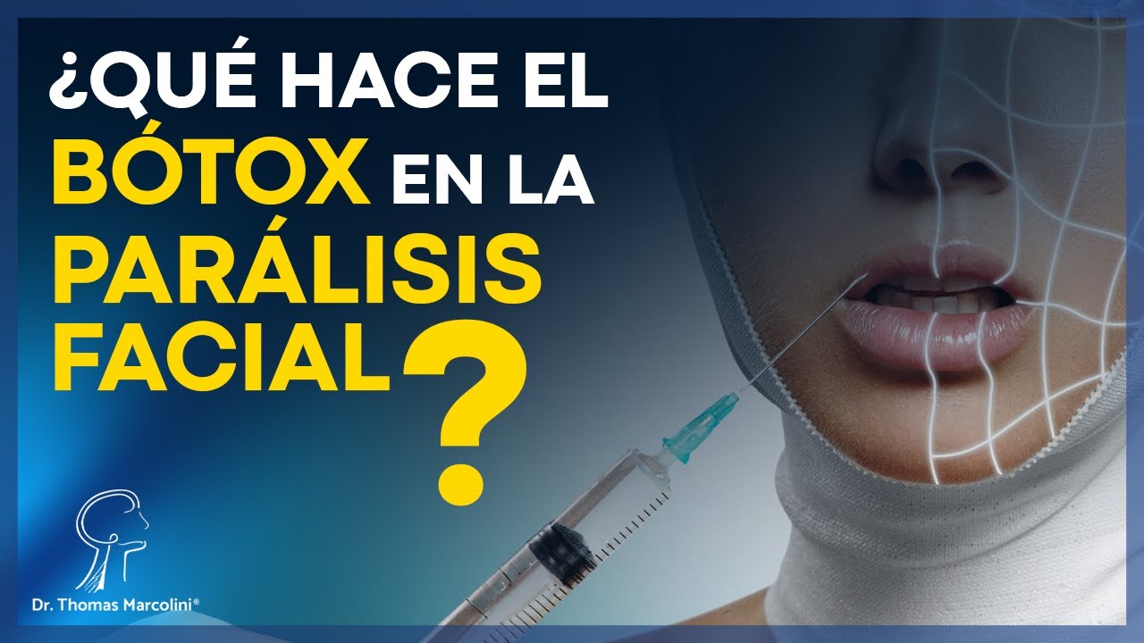 Botox y parálisis facial, ¡Todo lo que Necesitas Saber!
