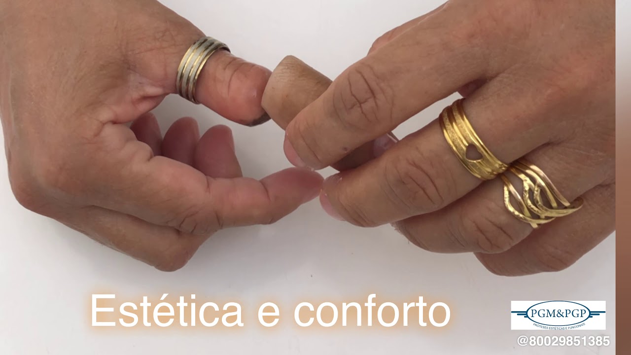 Prótese para amputação de polegar