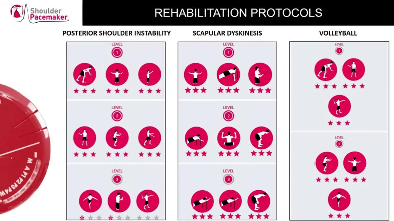The Shoulder Pacemaker™ device | The MAS stimulator to treat shoulder: what is it and how it works