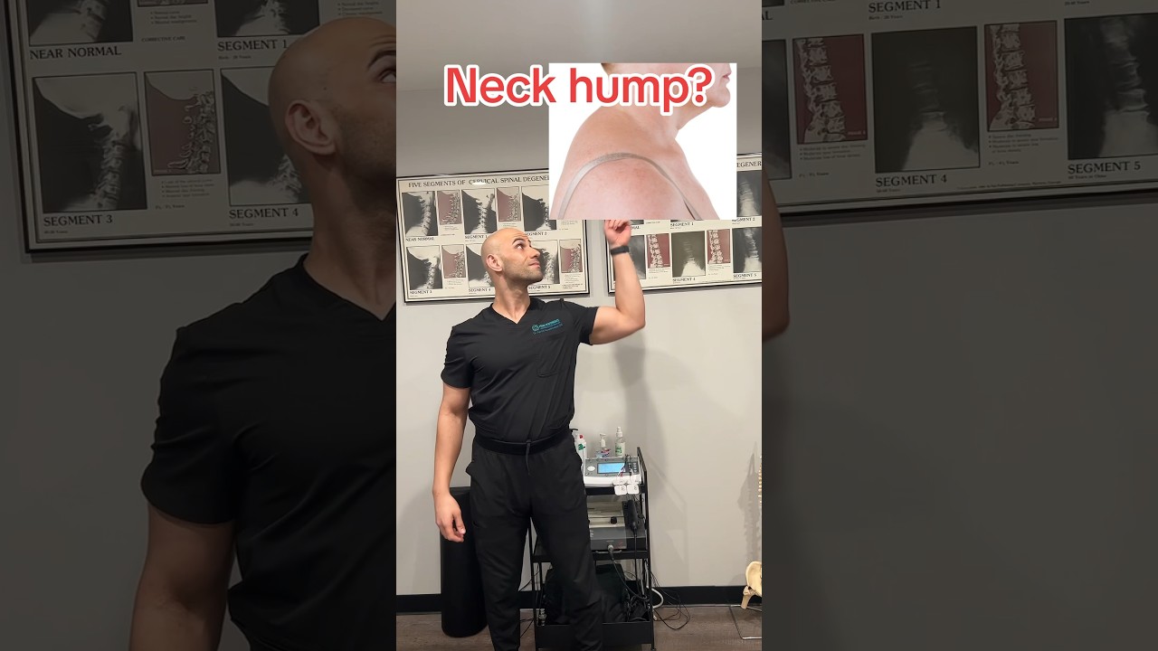 Neck hump? Try this and share! #shorts #tips #viral #trending