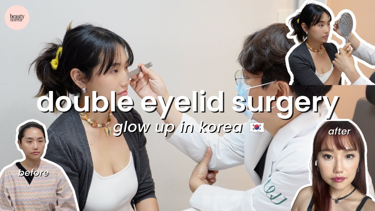 I Got Double Eyelid Surgery in Korea! Come With Me (ft. Beauty Hopper)