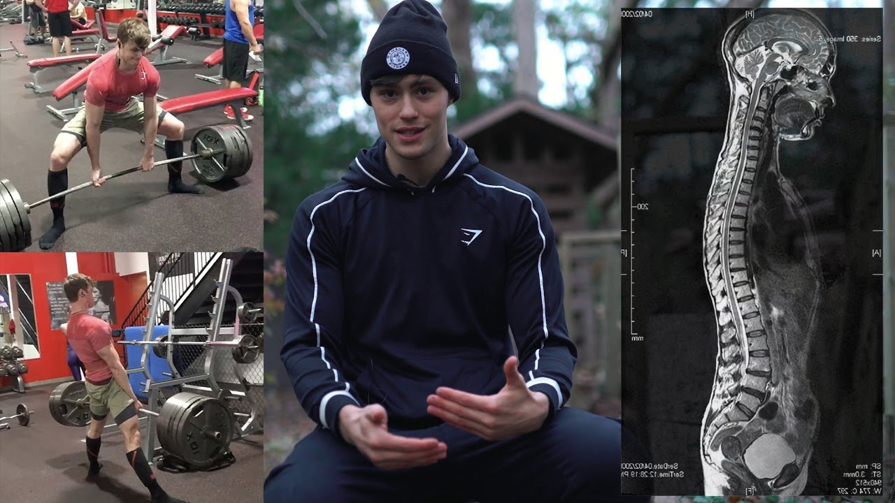 Погубил СПИНУ/ РЕЗУЛЬТАТЫ МРТ | David Laid Q&A