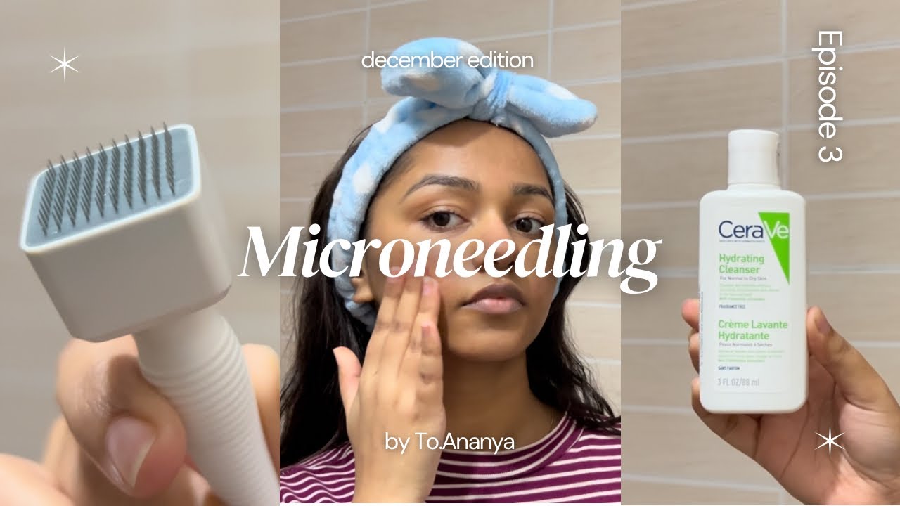 Get Rid Of Acne Scars | Microneedling + Postcare