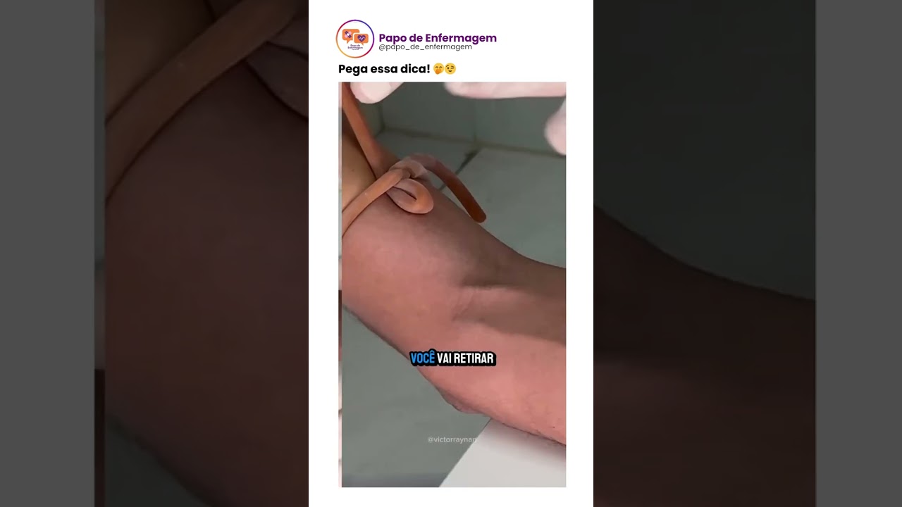 Dicas de ouro para um acesso venoso perfeito 😉