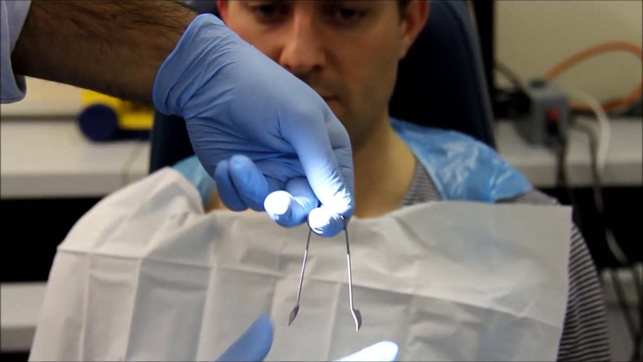 How to remove foreign bodies from the nose