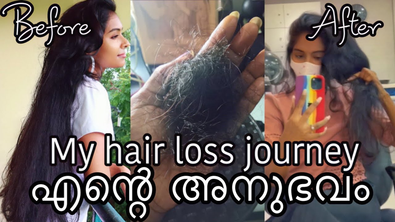 How I am trying to grow back my hair WITHOUT any treatments | Live results |Asvi Malayalam