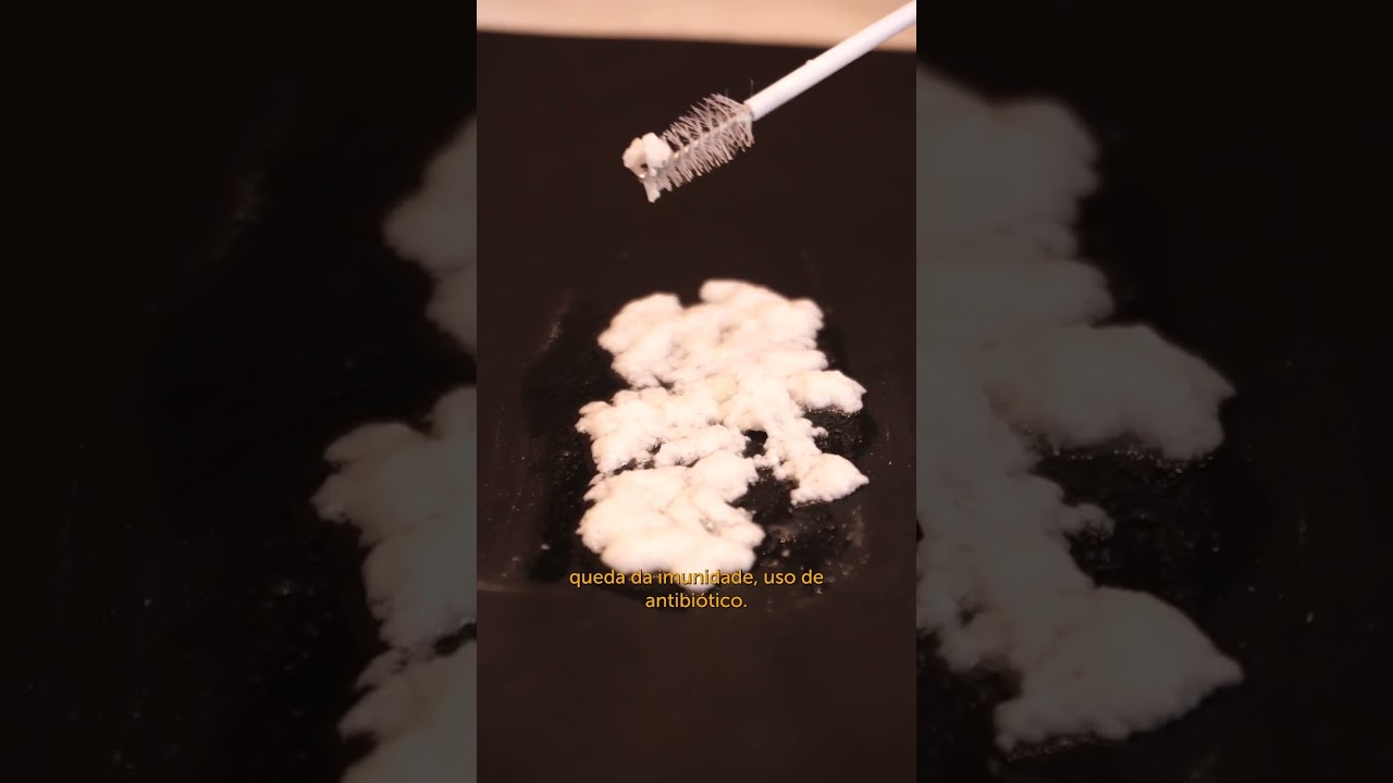 Tipos de corrimento que a  mulher pode ter.