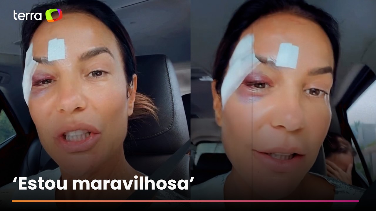 Ivete Sangalo comemora alta hospitalar após desmaio e brinca: ‘Maquiagem diferente’