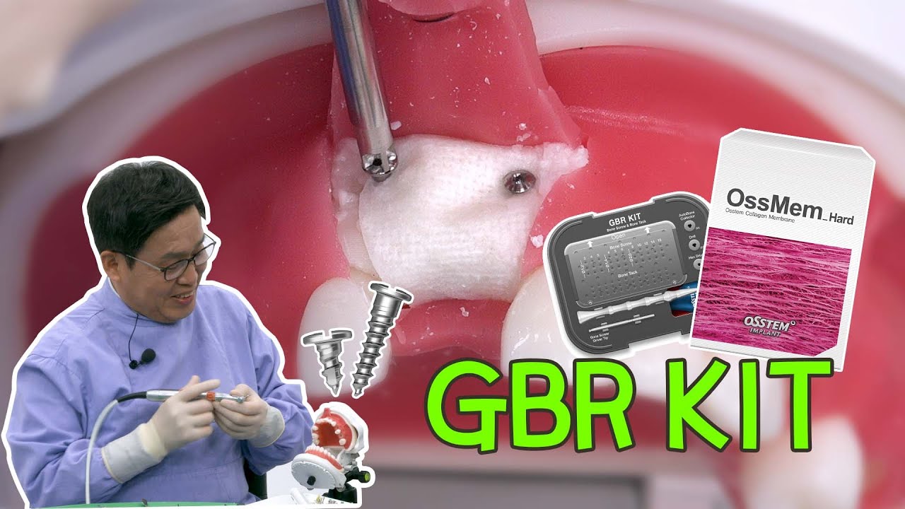 [EASY Hands-on] GBR KIT - #11 Missing Case