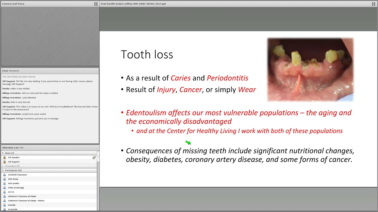 Geriatric Oral Health: Navigating Chronic Disease and Oral Dryness