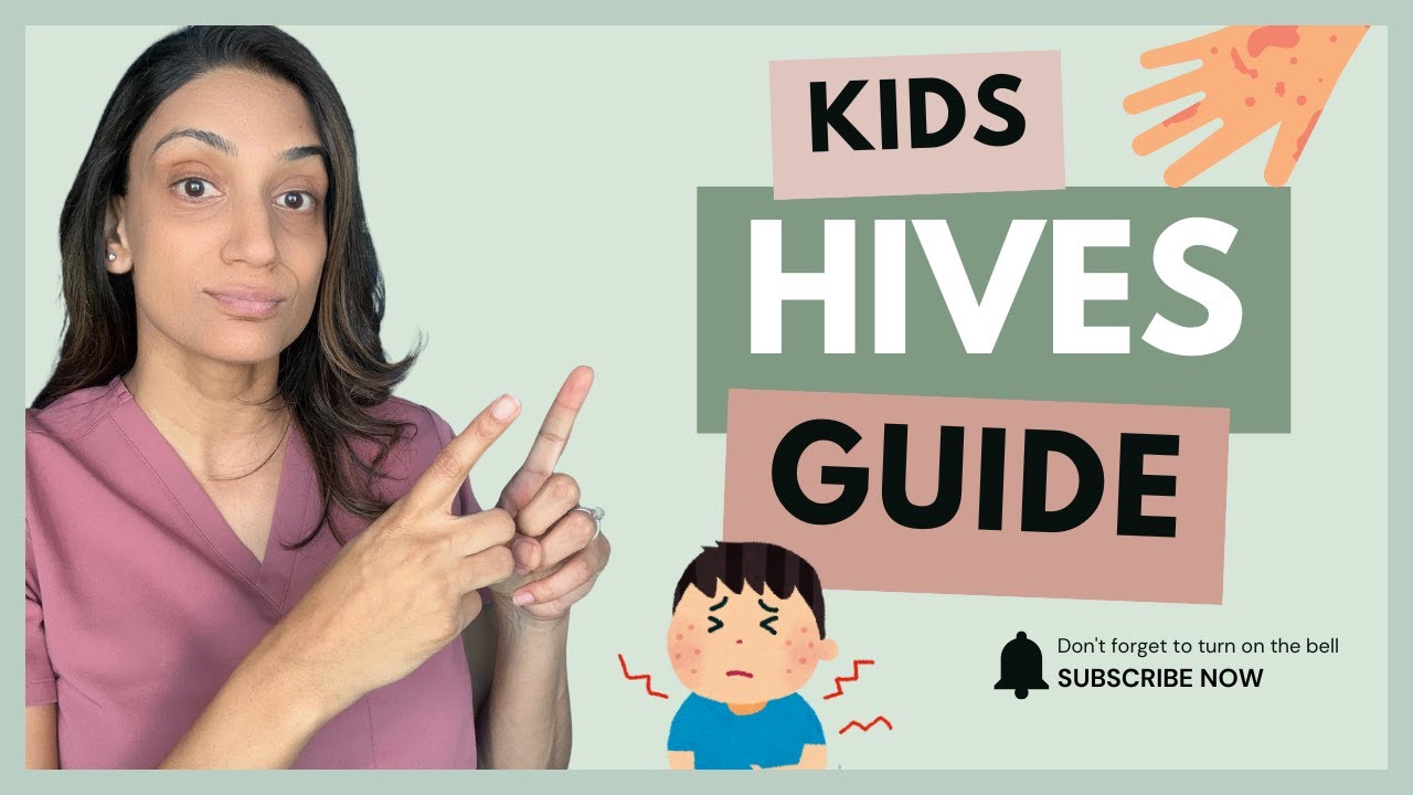 Hives in Kids: Causes, Treatment at Home, and When to See a Doctor