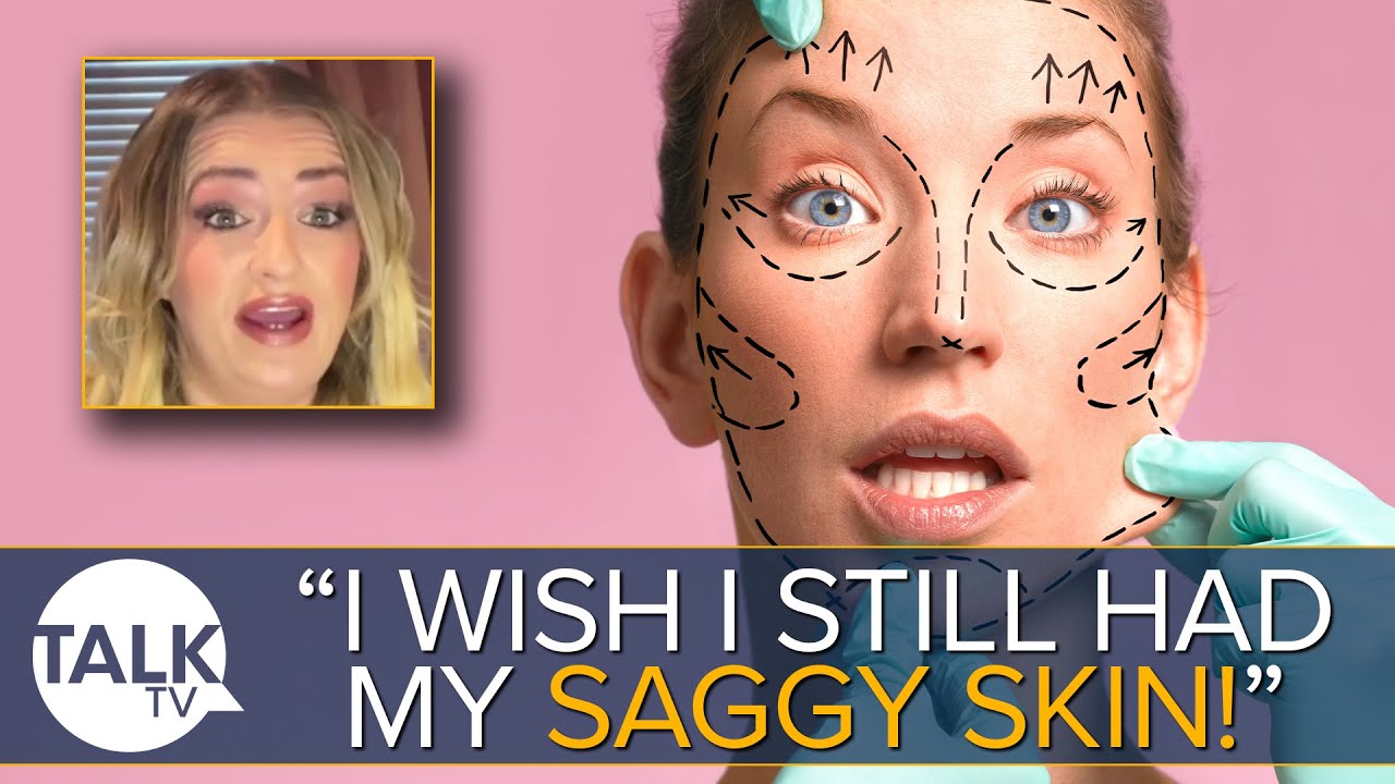 “It’s Really Not Worth It!” Botched Surgery Victim Warns AGAINST Cosmetic Procedures Abroad