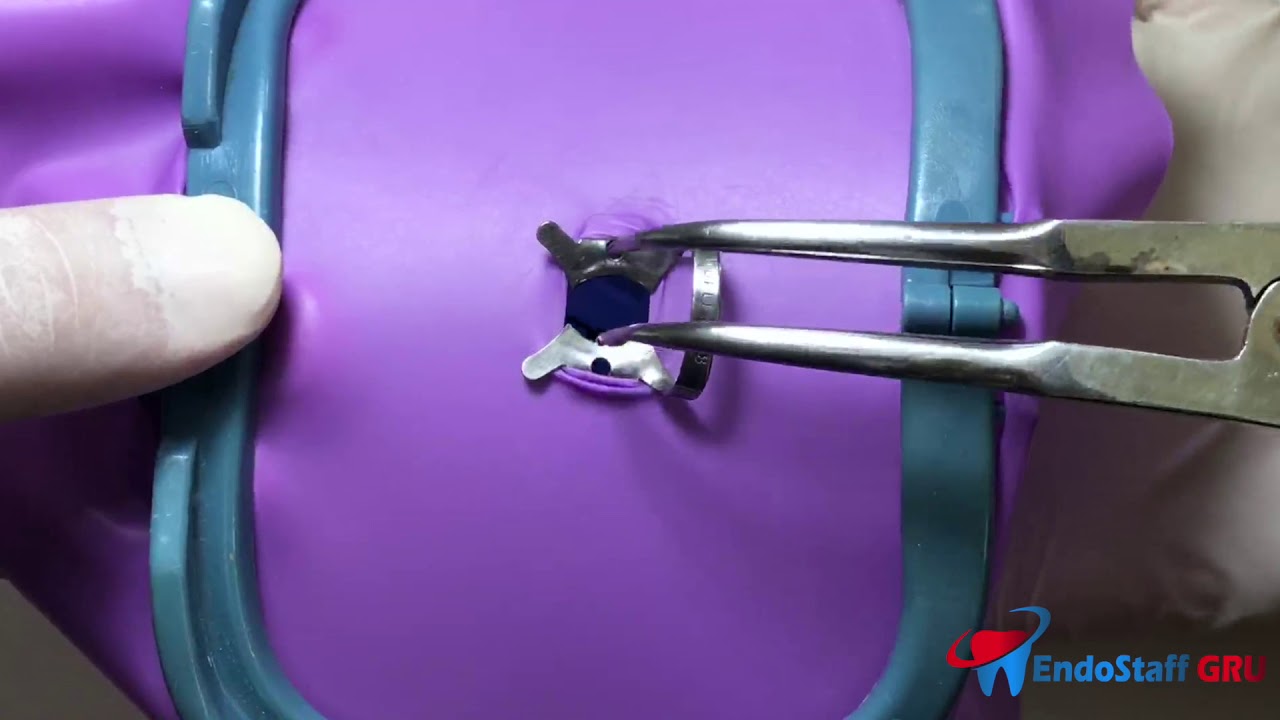 Isolamento Absoluto - Técnica GRAMPO + LENÇOL + ARCO
