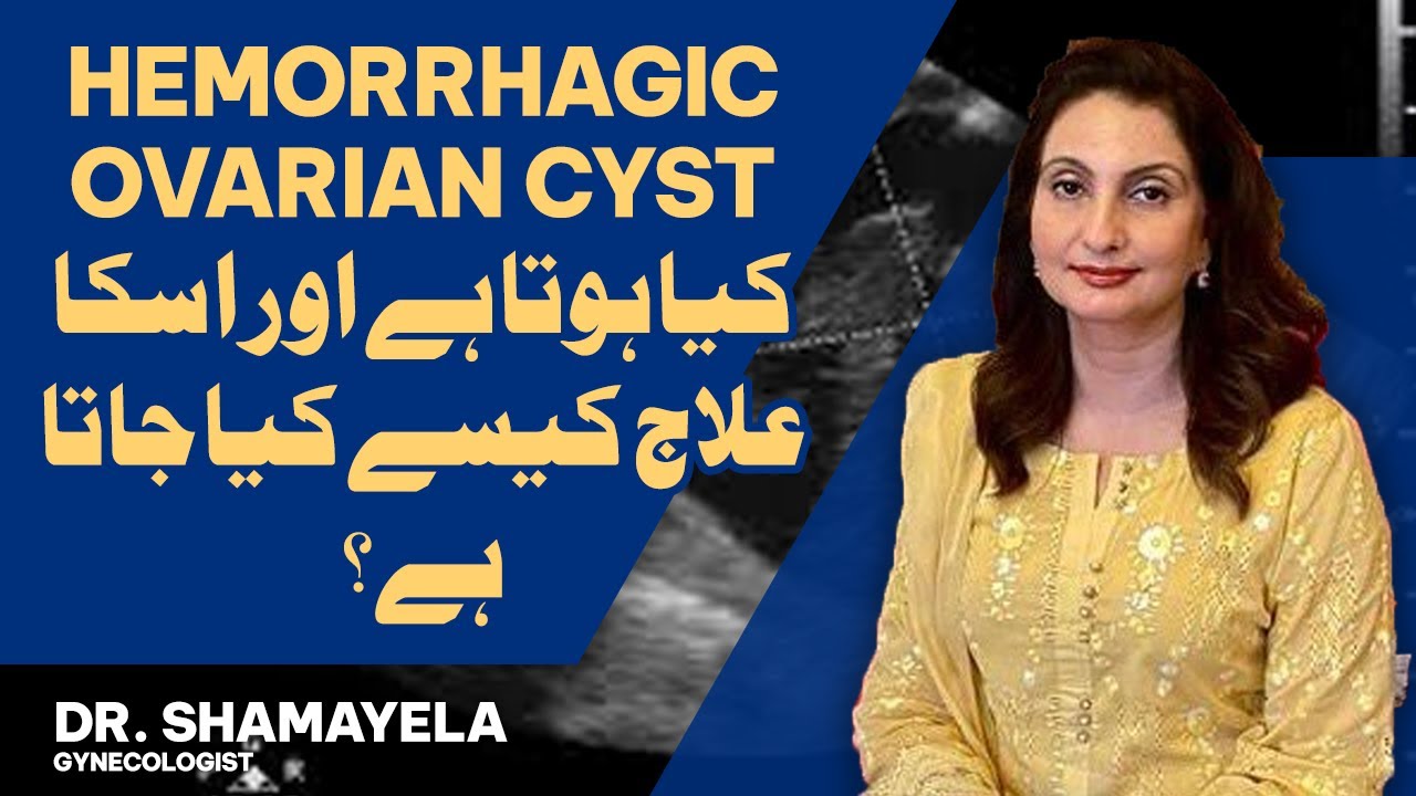 Hemorrhagic Ovarian Cyst Explained By Dr. Shamayela Hanif, Gynecologist In Urdu/Hindi