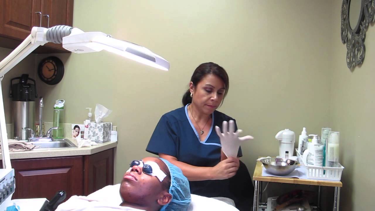 Salicylic Acid Peel (Beverly Dermatology & Laser Center)