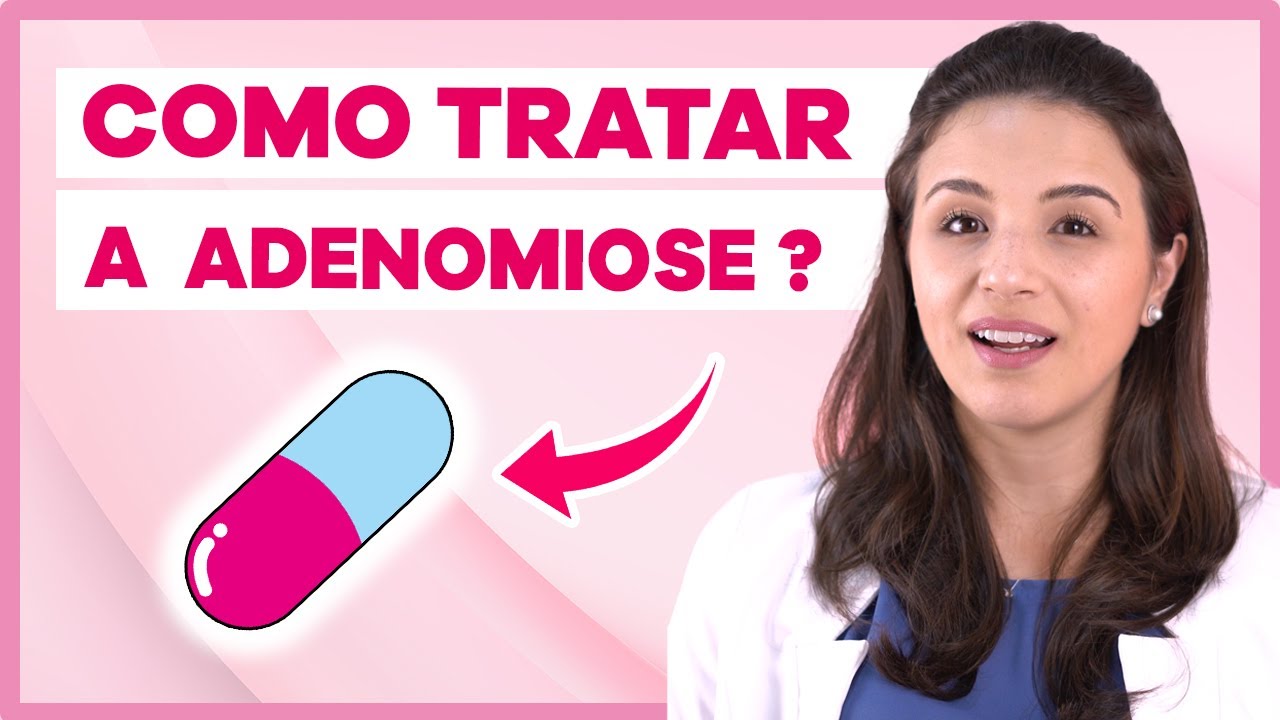 Como tratar a Adenomiose?