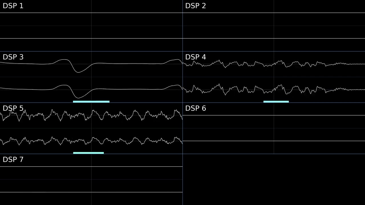 EarthBound - Pokey Means Business! [Oscilloscope Deconstruction]